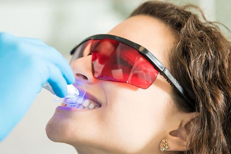 Composite Bonding Knightsbridge