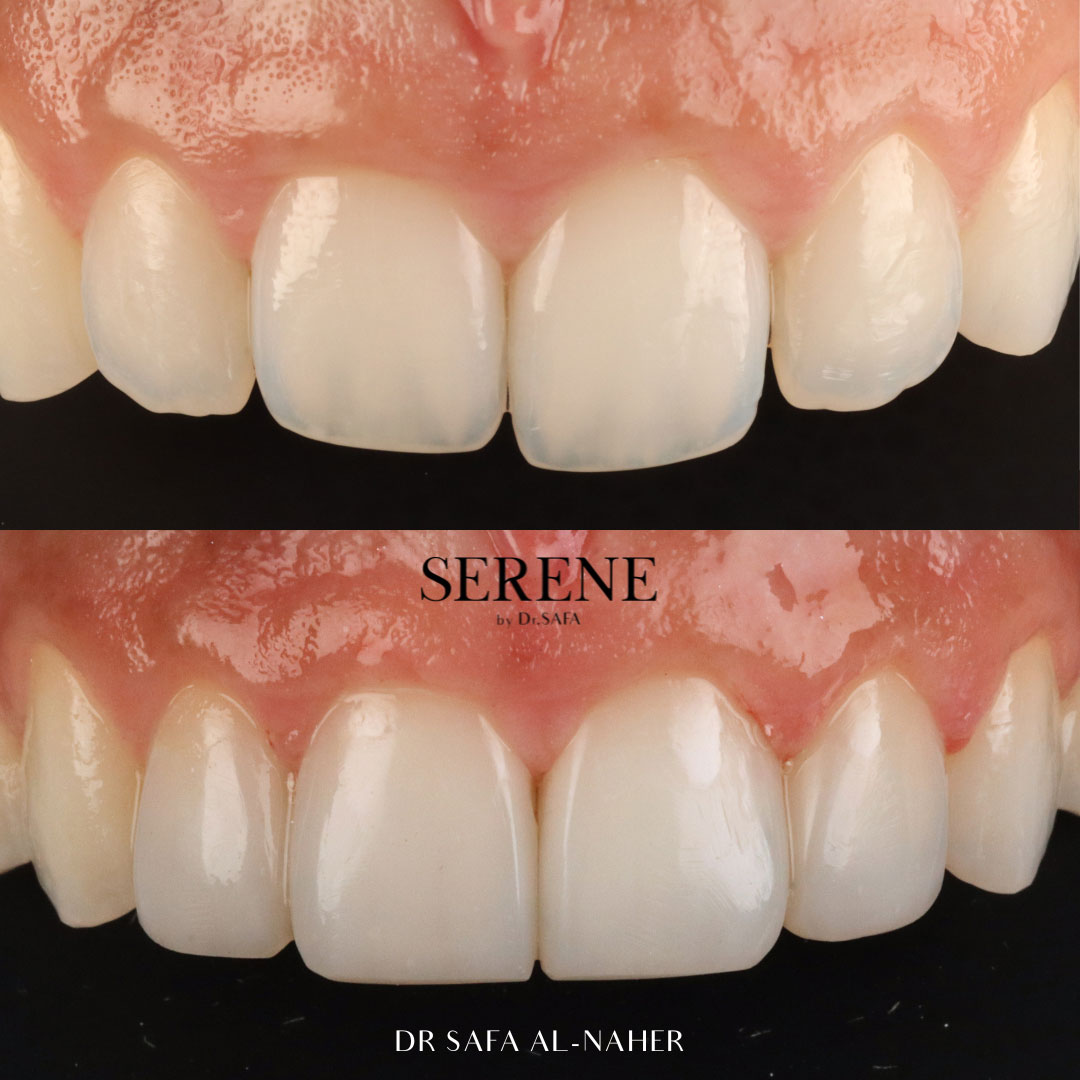 before-and-after-comp-8