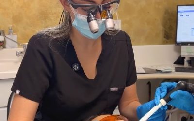 Summer Smile Makeover in London